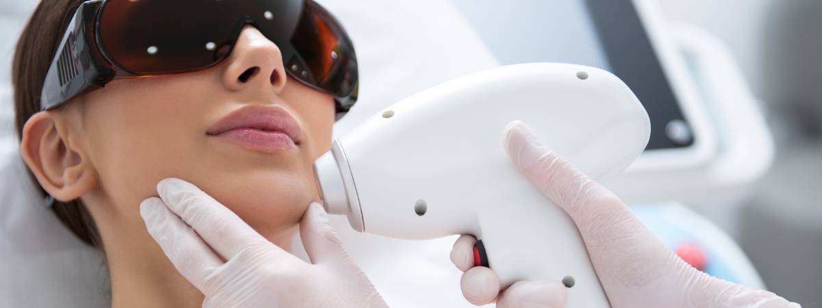Adevărul despre epilarea definitivă cu laser – Mituri și așteptări